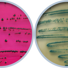 Экспресс-методы выявления патогенных микроорганизмов в продуктах питания